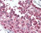 MNSOD / SOD2 Antibody